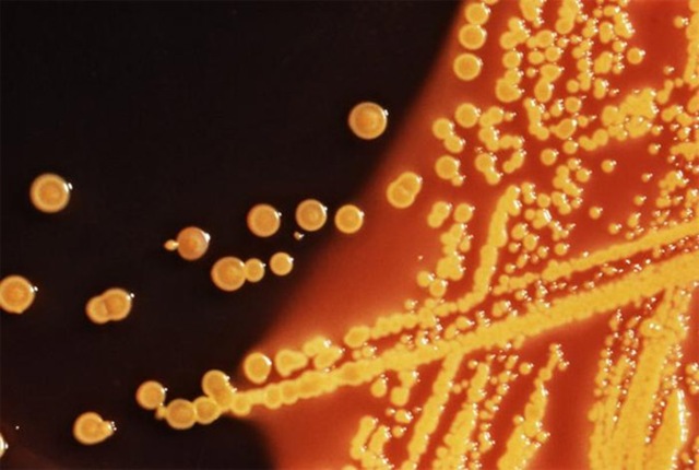 Des bactéries synthétiques kamikazes, pour détecter et tuer d’autres bactéries.