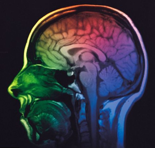 Une nouvelle étude renforce l’hypothèse selon laquelle le virus de l’herpès entraînerait la maladie d’Alzheimer