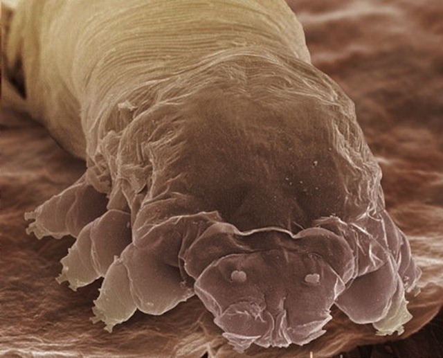 Voici Demodex Folliculorum, il crapahute sur votre visage et ses excréments provoqueraient la couperose.