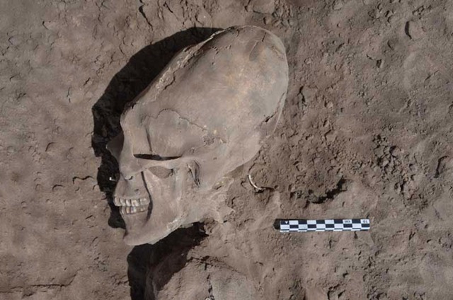 Cas paléontologiques mexicains de déformations volontaires du crâne.