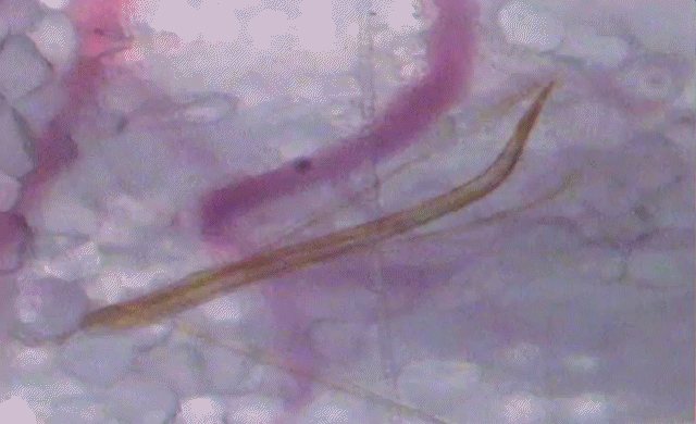 Regardez de l’intérieur la piquante tête chercheuse du moustique en quête de sang (Vidéos)