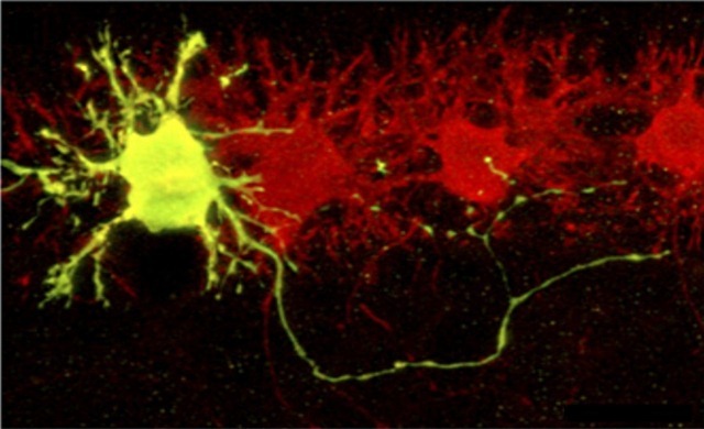 La durée de vie d’un neurone varie en fonction de l’organisme qui le porte