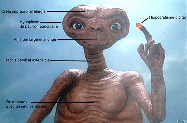 Pourquoi E.T n’était vraiment pas fait pour voyager dans l’espace ?