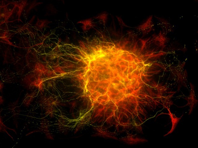 L’image du jour : une "Neurosphère" navigue dans son nouvel univers.