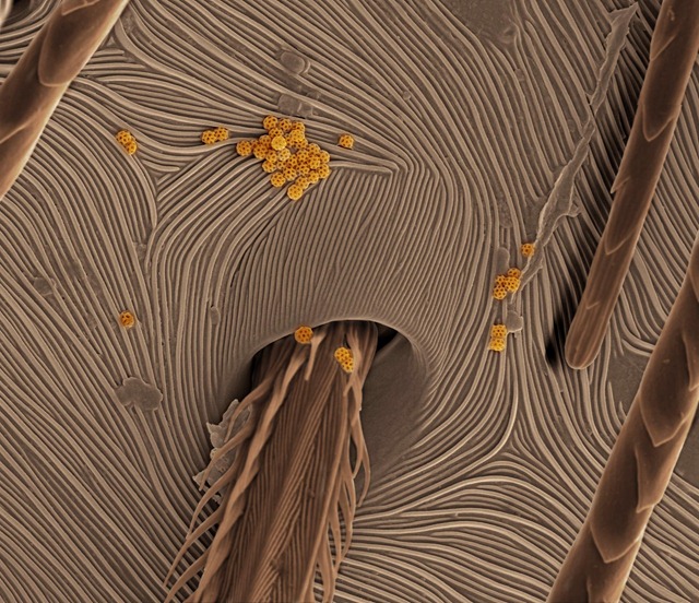Un gros zoom sur une peau d’araignée et une face de chenille.