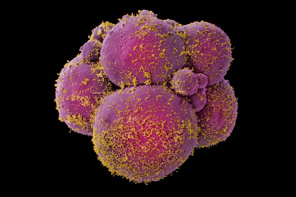 La première tentative controversée de modification génétique d’embryons humains