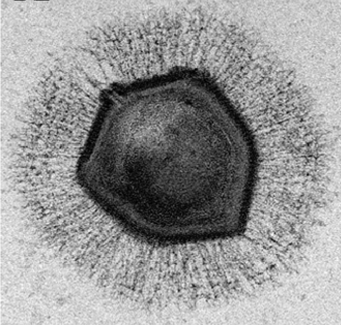 “CRISPR-iesque” : certains virus géants savent aussi couper-coller l’ADN de leurs ennemis