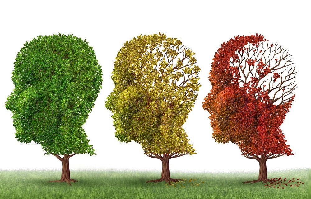 Un nouveau médicament inverse de 3 manières différentes les symptômes de la maladie d’Alzheimer… chez des souris
