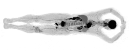 Le premier scanner d’imagerie médicale à capturer une image 3D du corps humain en un seul passage
