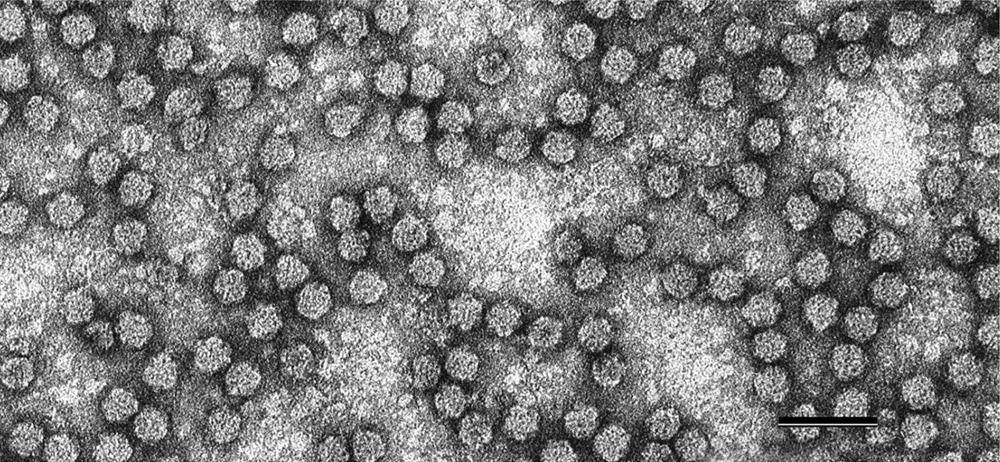 Une découverte qui pourrait radicalement changer nos connaissances sur la façon dont certains virus se propagent