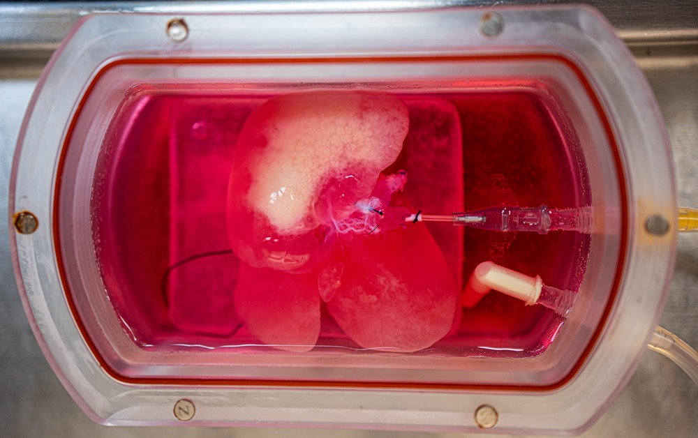 Premiers mini foies humains créés artificiellement pour tester des traitements hépatiques