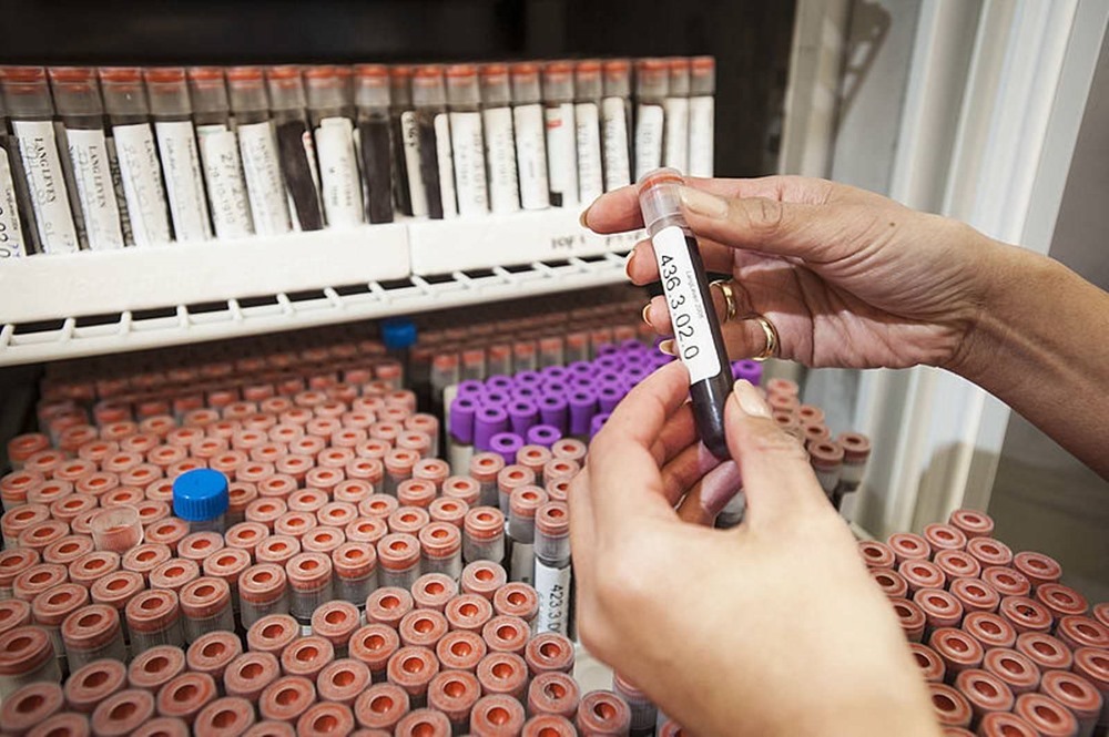 Un nouveau test sanguin pourrait prédire le risque de décès d’une personne au cours des 10 prochaines années