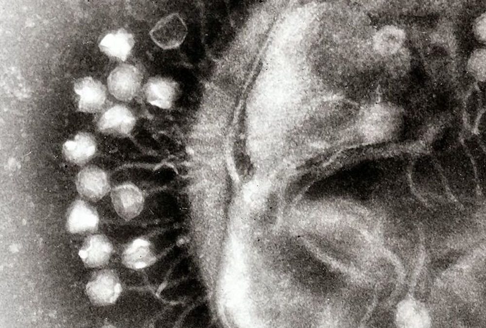 Des virus géants aux caractéristiques inédites s’attaqueraient aux microbes dans nos intestins