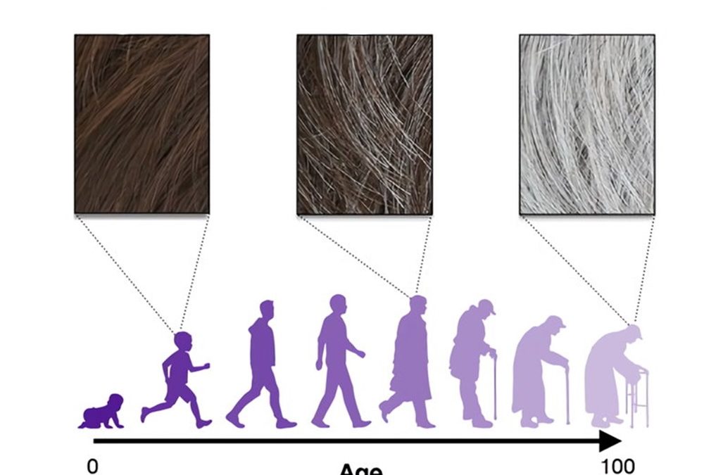 Le stress peut rendre les cheveux gris, et ce phénomène pourrait être inversé