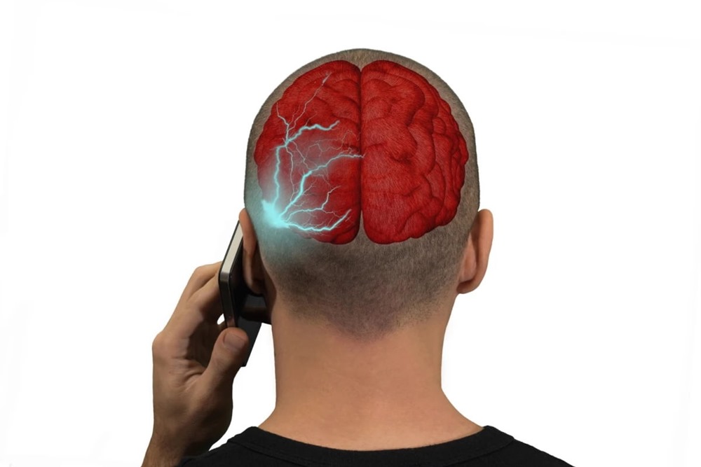 Selon une grande et longue étude, il n’y a pas de lien entre l’utilisation de téléphone portable et les tumeurs cérébrales
