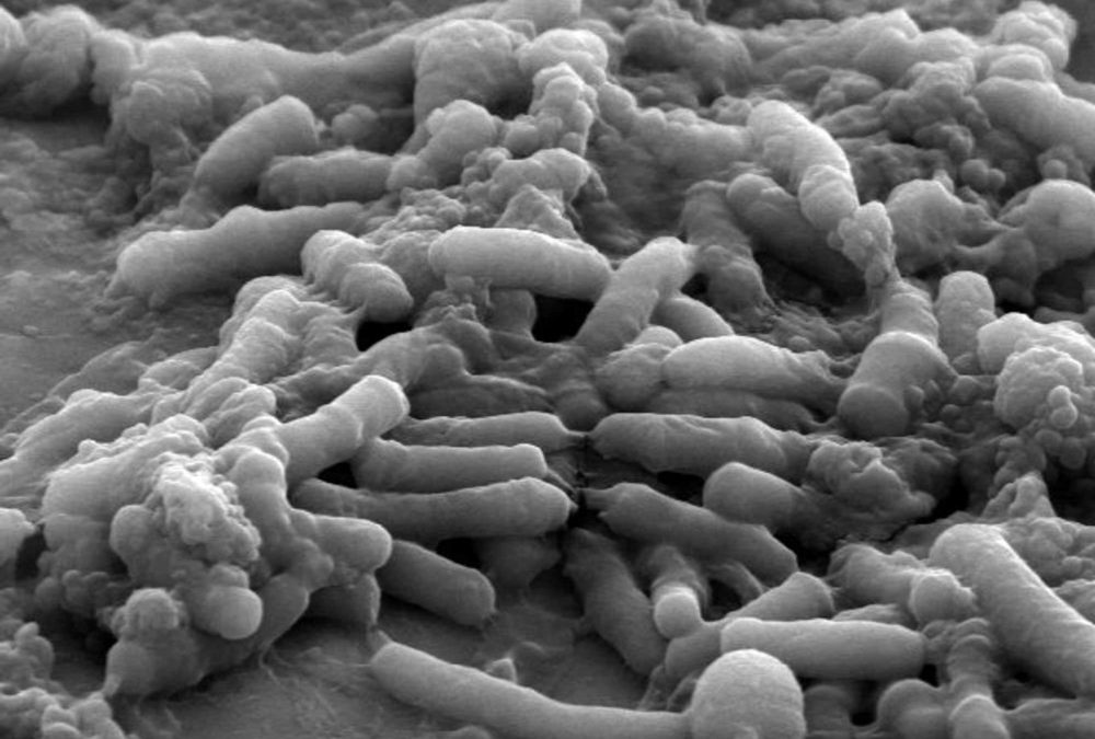 Des bactéries modifiées pour produire dans l’intestin un médicament contre la maladie de Parkinson