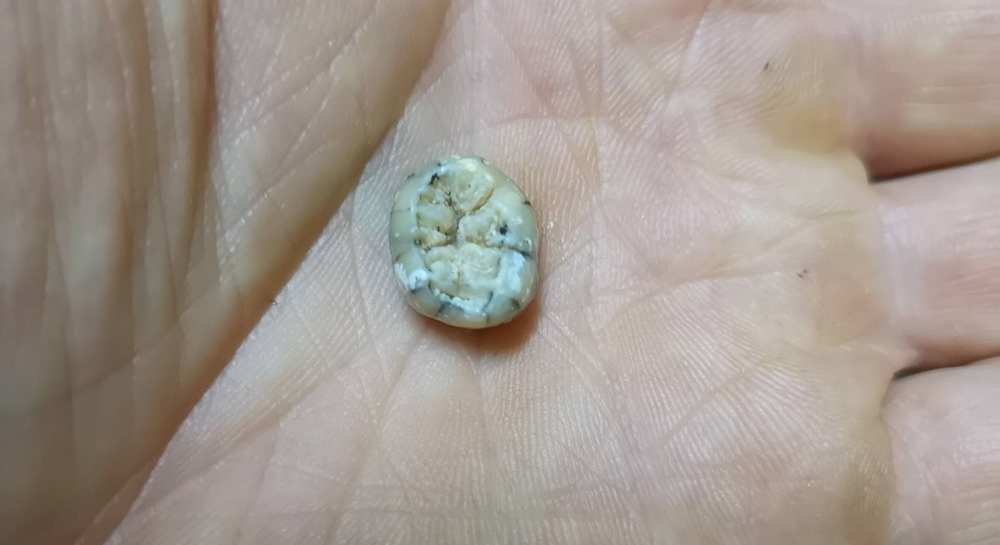 Une dent vieille de 150 000 ans représente une rare preuve de la présence des Dénisoviens
