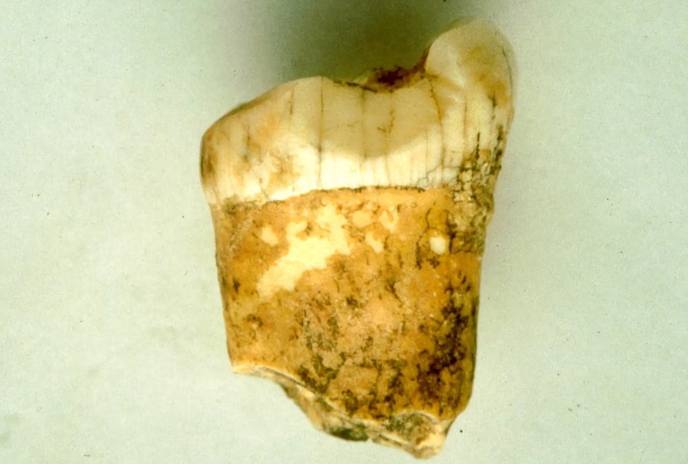L’émail des dents des Néandertaliens indique qu’ils étaient peut-être carnivores