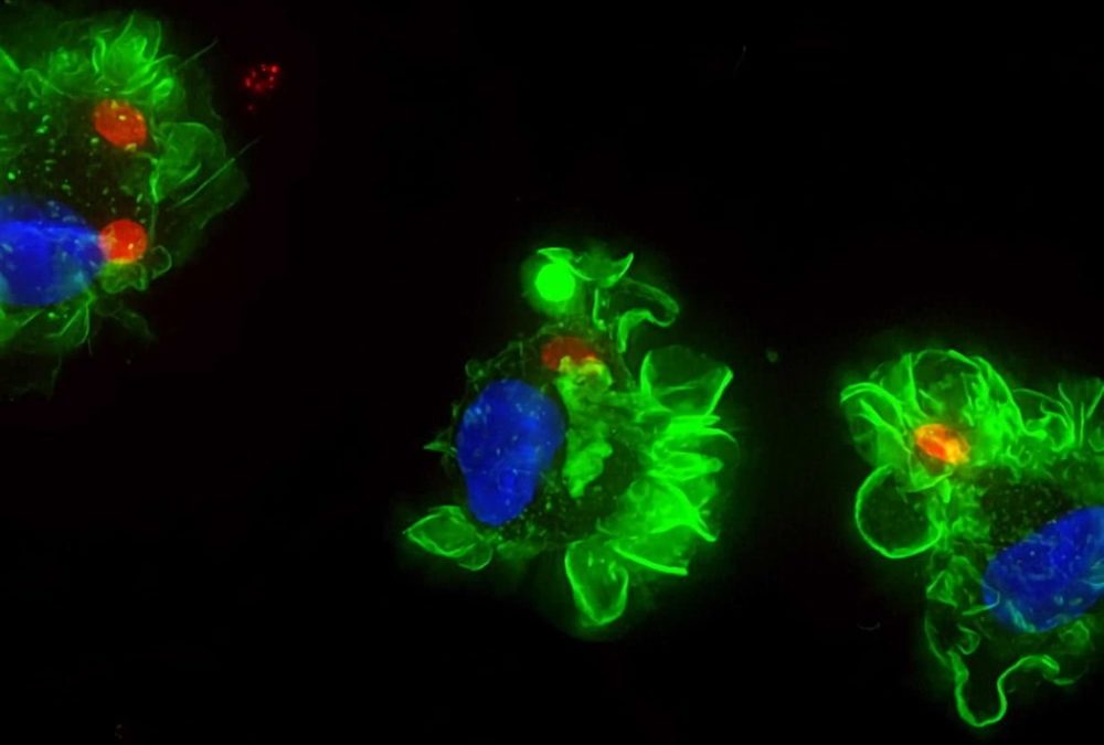Le parasite du chat Toxoplasma peut pirater des cellules pour tromper notre système immunitaire