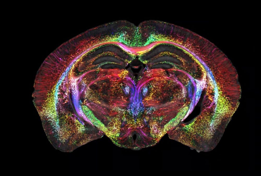 Des scanners du cerveau devenues 64 millions de fois plus précis
