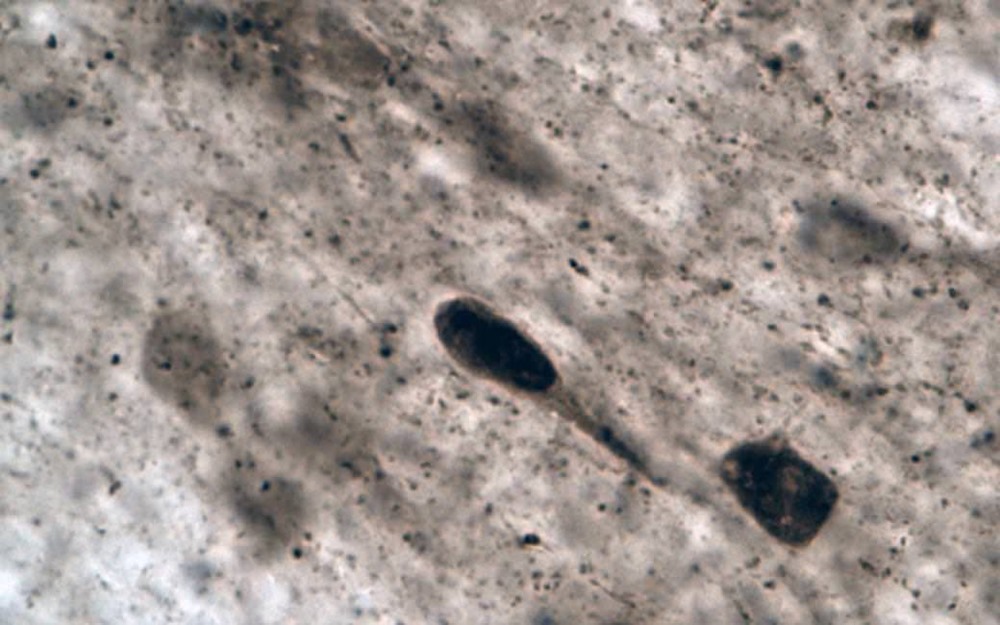 Une souche de bactéries intestinales contribue au développement de la maladie de Parkinson