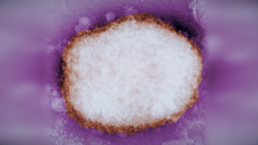 La variole du singe évolue chez les humains depuis au moins 2016