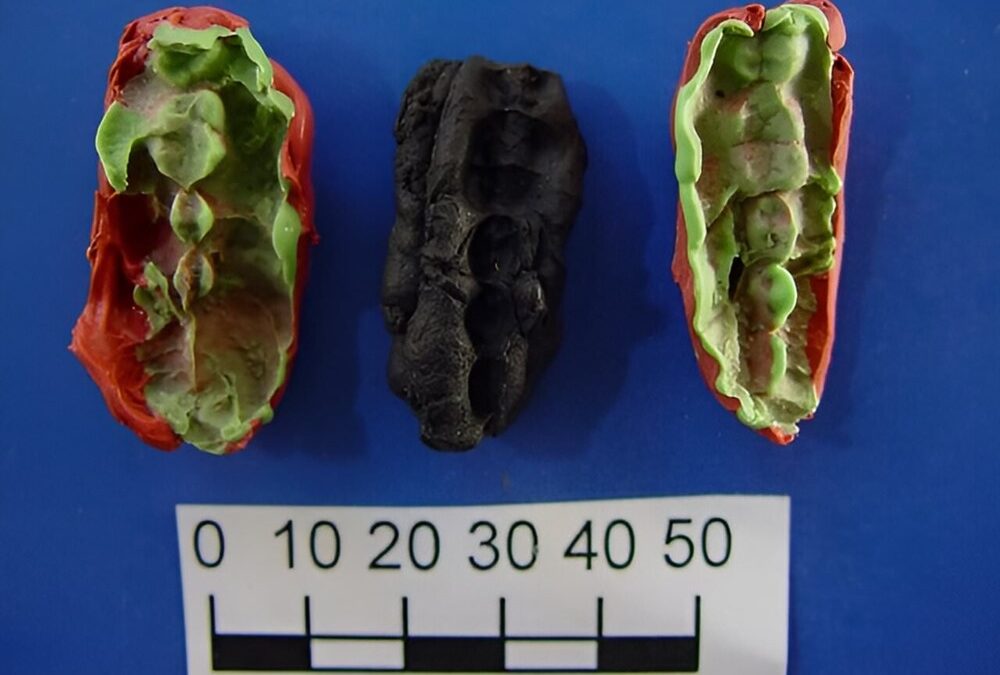 Un vieux chewing-gum du néolithique révèle un ancien régime alimentaire et des problèmes dentaires
