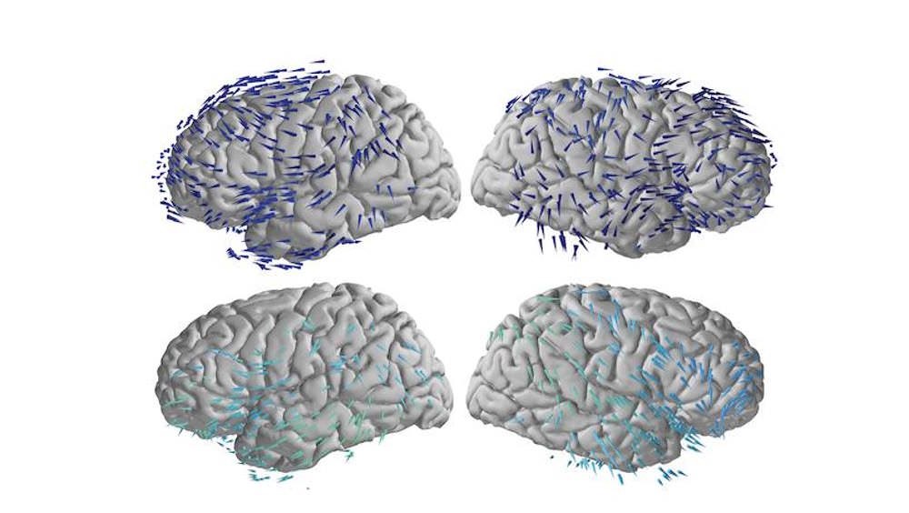 Comme des vagues neuro-électriques : des scanners montrent comment le cerveau mémorise et se souvient