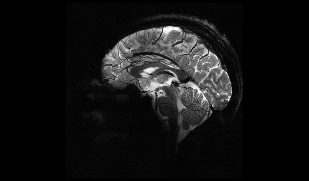Premières images du cerveau réalisées par l’appareil d’IRM le plus puissant du monde