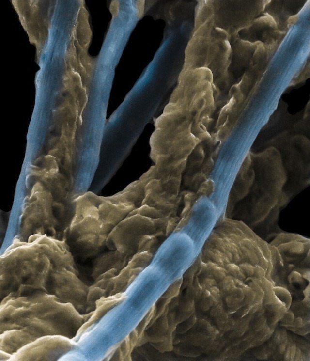 Un nouveau type de bactéries qui s’alignent pour former des câbles électriques vivants.
