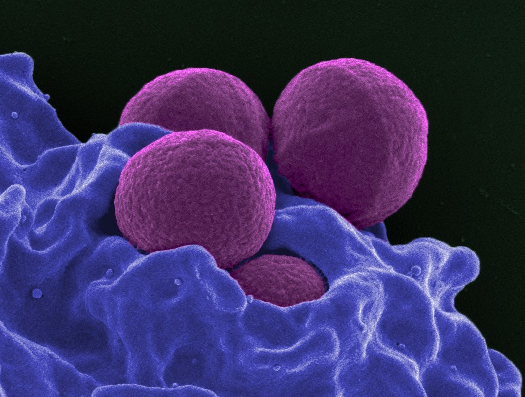 Une liste des 12 plus dangereuses superbactéries pour interpeler les entreprises pharmaceutiques