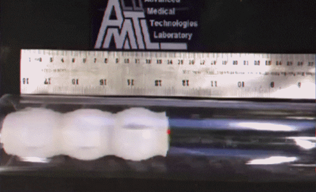 Un robot qui peut s’introduire dans votre rectum pour se balader dans votre colon (vidéo)
