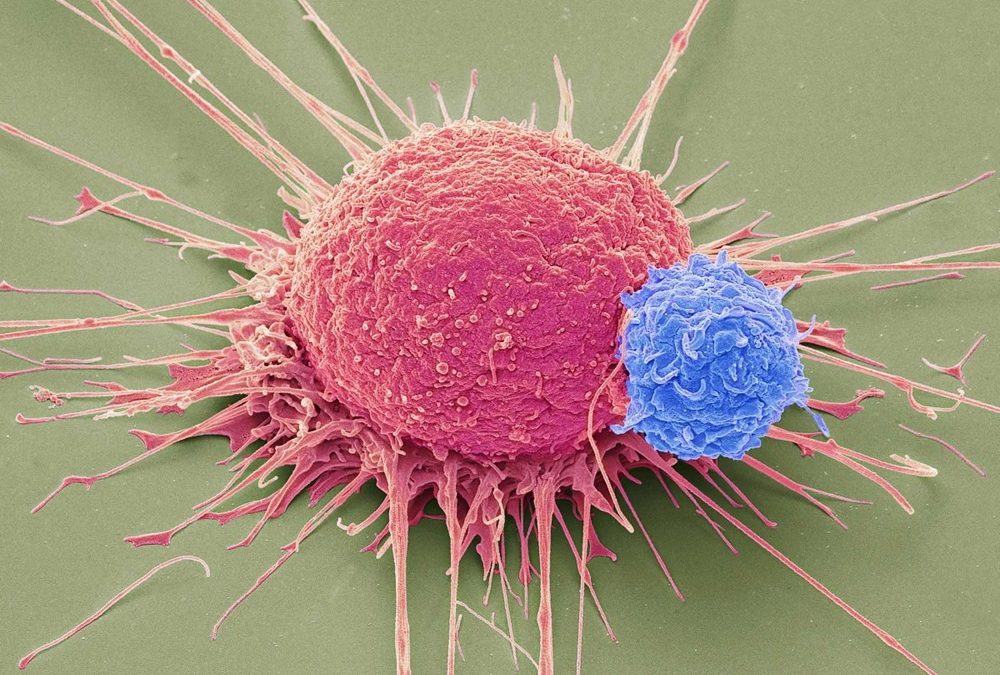 Chez les patients qui ont réussi à vaincre le cancer, des scientifiques ont découvert de nouvelles cellules T "supérieures" capables de s’attaquer à plusieurs cibles cancéreuses