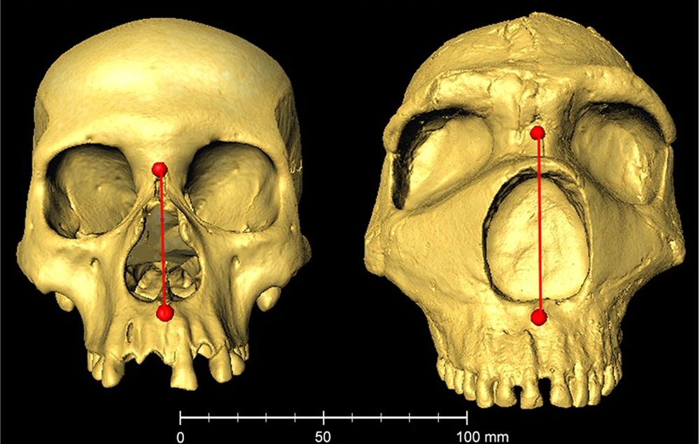 Notre gros nez pourrait être le résultat d’une ancienne liaison avec un Néandertalien